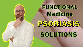Functional Medicine: Your Path to Managing Psoriasis Symptoms