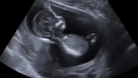 What Happens To Unborn Babies #HolySpirit - Hugo Talks