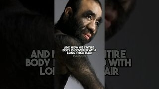 This Man Looks Like An Ape!