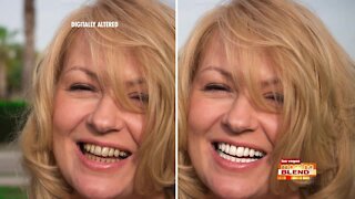 The Easiest Way to a Whiter Smile