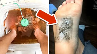 Soak Your Feet In This Mixture To Detox Your Skin And Relax