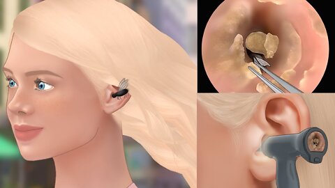 Satisfying! Bug removal & ear cleaning animation - tingle sound [ASMR]