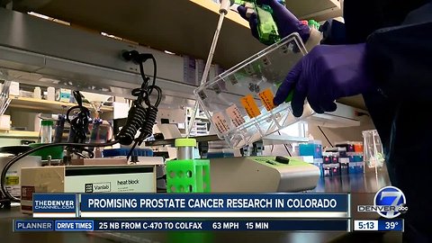 Colorado on the forefront of prostate cancer research