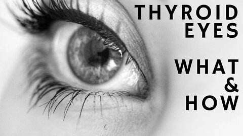 Thyroid Eyes - Know What Causes and How to Recognize them