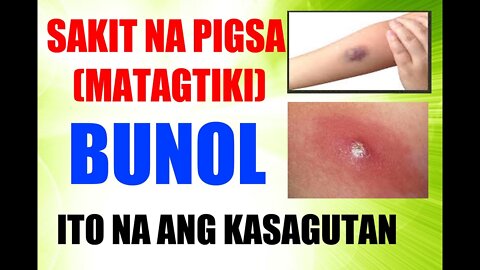 GAMOT PARA SA PIGSA MATAG TIKI O BUNOL/ ANG HERBAL NA PINAKAMABISA