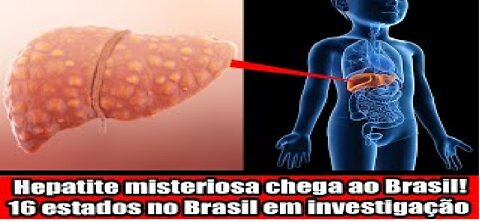 Hepatite misteriosa chega ao Brasil! 16 estados no Brasil em investigação