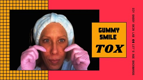 Gummy Smile - Tox Technique
