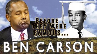 BEN CARSON | Before They Were Famous