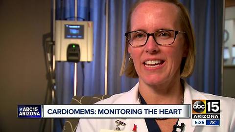 Cardiomems helping Valley patients to monitor their heart