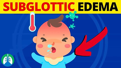 Diagnosing a Child with Subglottic Edema (TMC Practice Question)