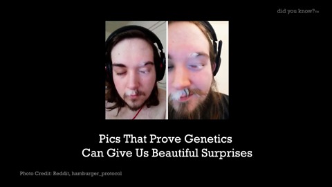 Pics That Prove Genetics Can Give Us Beautiful Surprises