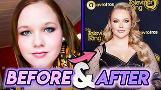 NikkieTutorials | Before and After Transformations | Her Cosmetic Surgery and More