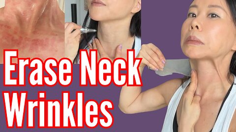 Erase Neck Wrinkles | Koko Face Yoga