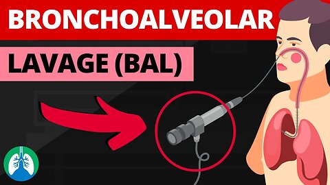 Bronchoalveolar Lavage (BAL) (Medical Definition) | Quick Explainer Video