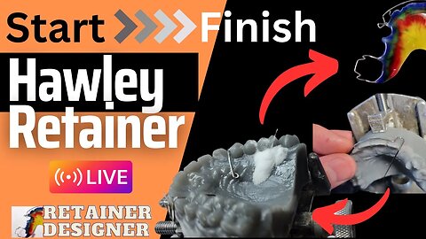 Watch as I Create a Hawley Retainer Start To Finish LIVE!