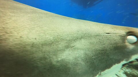 Both Lower Legs Severed in Tiger Shark Attack