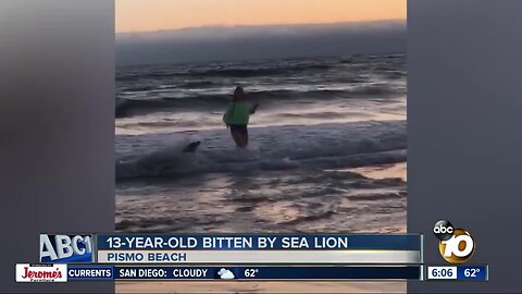 Sea lion bites 13-year-old girl on SoCal beach
