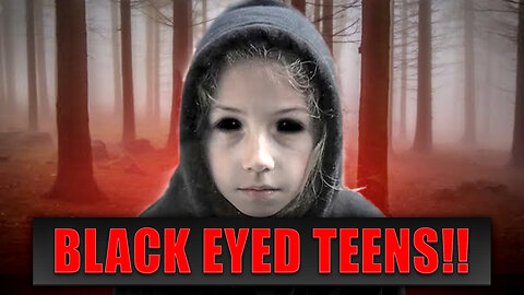 BLACK EYED TEENS!!