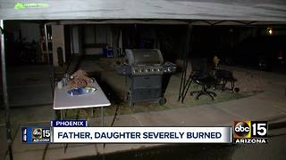 Girl and father severely burned in Phoenix