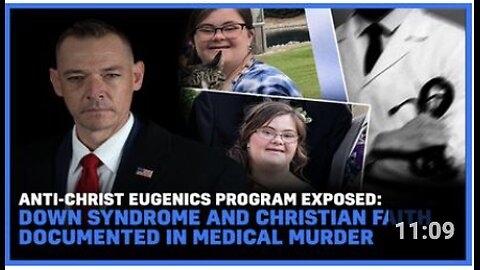 Eugenics Program Exposed: Down Syndrome And Christian Faith Documented In Medical Murder