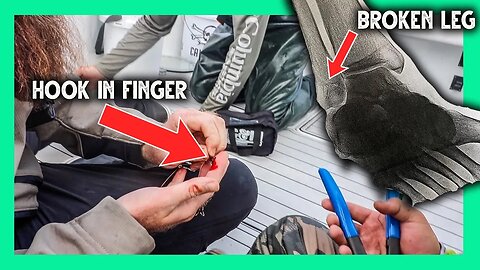I BROKE MY LEG AND GOT A HOOK IN MY FINGER While Deep Sea Fishing!