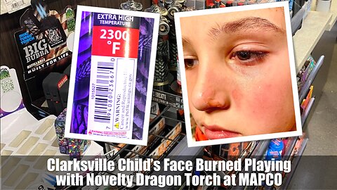 Clarksville Child’s Face Burned Playing with Novelty Dragon Torch at MAPCO