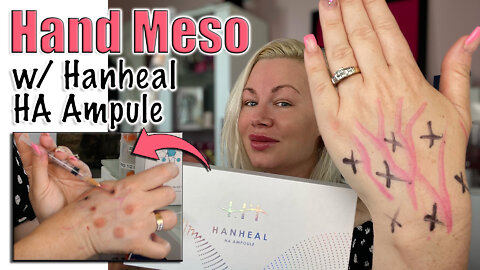 Rejuvinate Hands wit8h Hanheal HA Ampul meso therapy from Acecosm.com | Code Jessica10 Saves you $$$