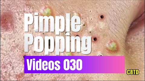 Satisfying Pimple Popping Videos 030