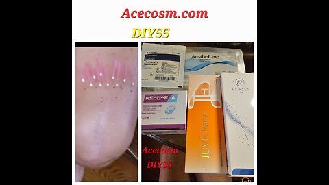 Knees legs Rejuvenation PDO threads Elaxen pn Juve Face Acecosm.com DIY55