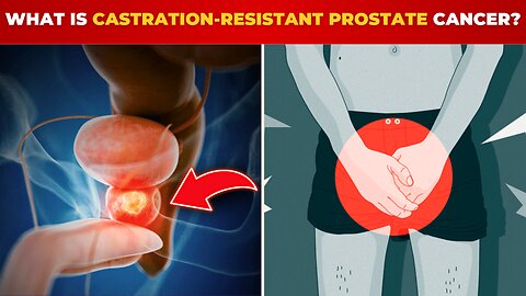 What Is Castration-Resistant Prostate Cancer: What You NEED to Know | Don't Panic!