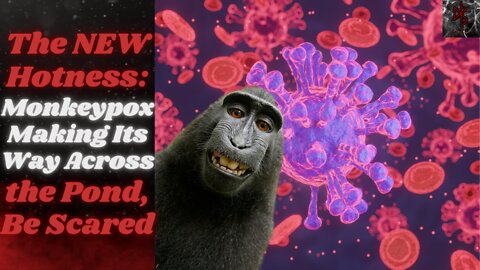 Monkeypox Hysteria Hits Western Shores! What the Hell Are You Worried About???