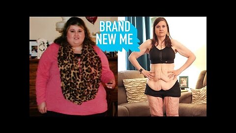 My 260lbs Weight Loss Left Me With 20lbs Of Loose Skin | BRAND NEW ME