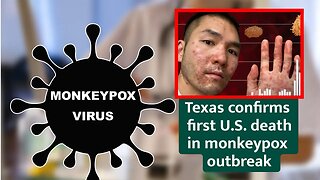 Texas confirms first US death in monkeypox outbreak, says patient was "severely immunocompromised"