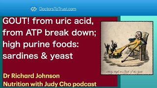 RICHARD JOHNSON 3 | GOUT! from uric acid, from ATP break down; high purine foods: sardines & yeast