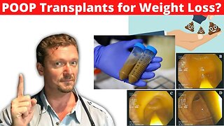 Poop Transplants for Weight Loss?! [FMT for Performance/Health?] 2022