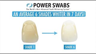 Valentines Day Smile With Power Swabs