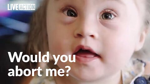 Abortion rejected by parents of child with Down syndrome