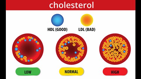 Lowering LDL Cholesterol - Use These Proven Tips for Reducing Your Bad Lipid