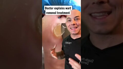 Doctor explains wart removal treatment! #wart #dermreacts #doctor