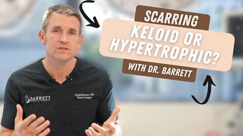 Keloid vs. Hypertrophic Scars!