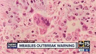 Measles vaccinations in Phoenix: See kindergarten school immunization rates