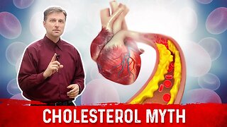The Cholesterol Myths & Facts
