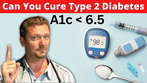 Can You Cure Type 2 Diabetes with Diet?? [Diabetes Reversal Explained] 2023