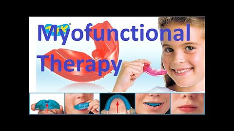 Facial Muscular Training with Orofacial Myology or Myofunctional Therapy Appliances by Prof John Mew