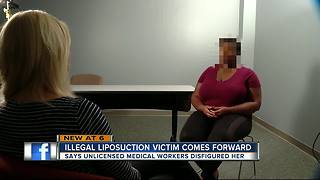 Illegal liposuction victim comes forward