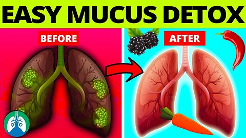 Top 10 Foods to Detox and Cleanse Mucus From Your Lungs