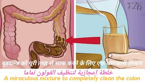 An amazing miraculous mixture to cleanse the colon completely & get rid of the puddle and old stool