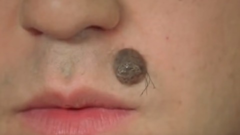 10 Bizarre Things About Moles That are Actually True