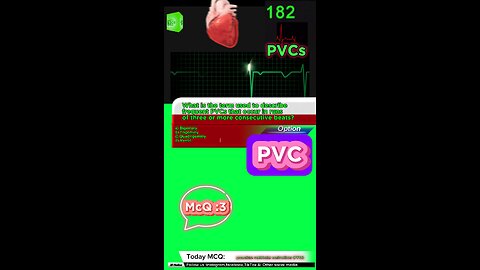 PVC #pvc #arrthymias #cardaic #heart prematureventricle tachycardia