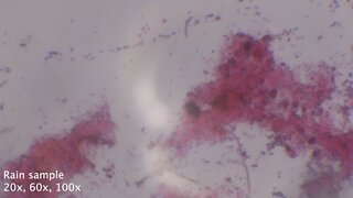 2022-10-07 Rain sample (Oct 6, 2022) gram stain